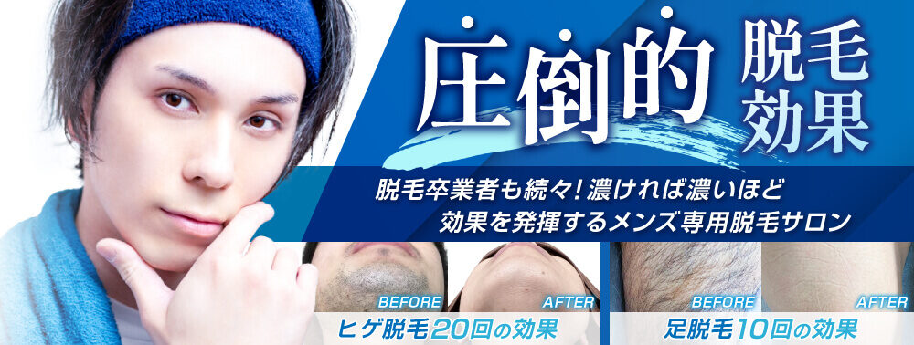 圧倒的脱毛効果　脱毛卒業者も続々！濃ければ濃いほど効果を発揮するメンズ専用脱毛サロン